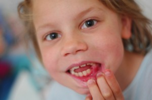 Da 421:  I didn't get back from London last night until way after the girls were fast asleep in bed.  This morning Ella was super-excited to show me that she'd lost her tooth at school yesterday